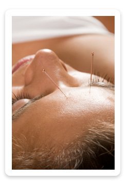 Acupuncture woman